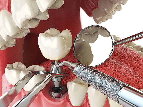 Best Emergency Dental Care for Broken or Chipped Teeth in Grandview Plaza, KS