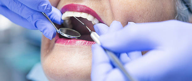 Best Emergency Dental Care for Broken or Chipped Teeth in Grandview Plaza, KS